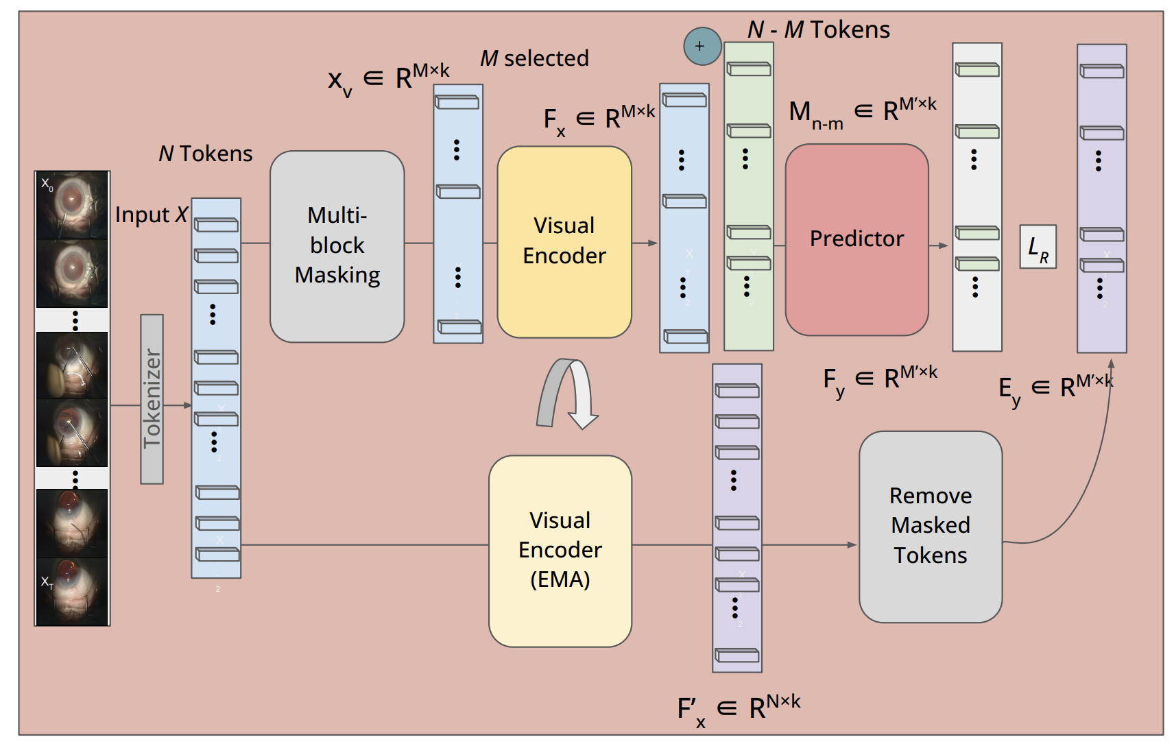 A Vision Foundation Model for Cataract Surgery